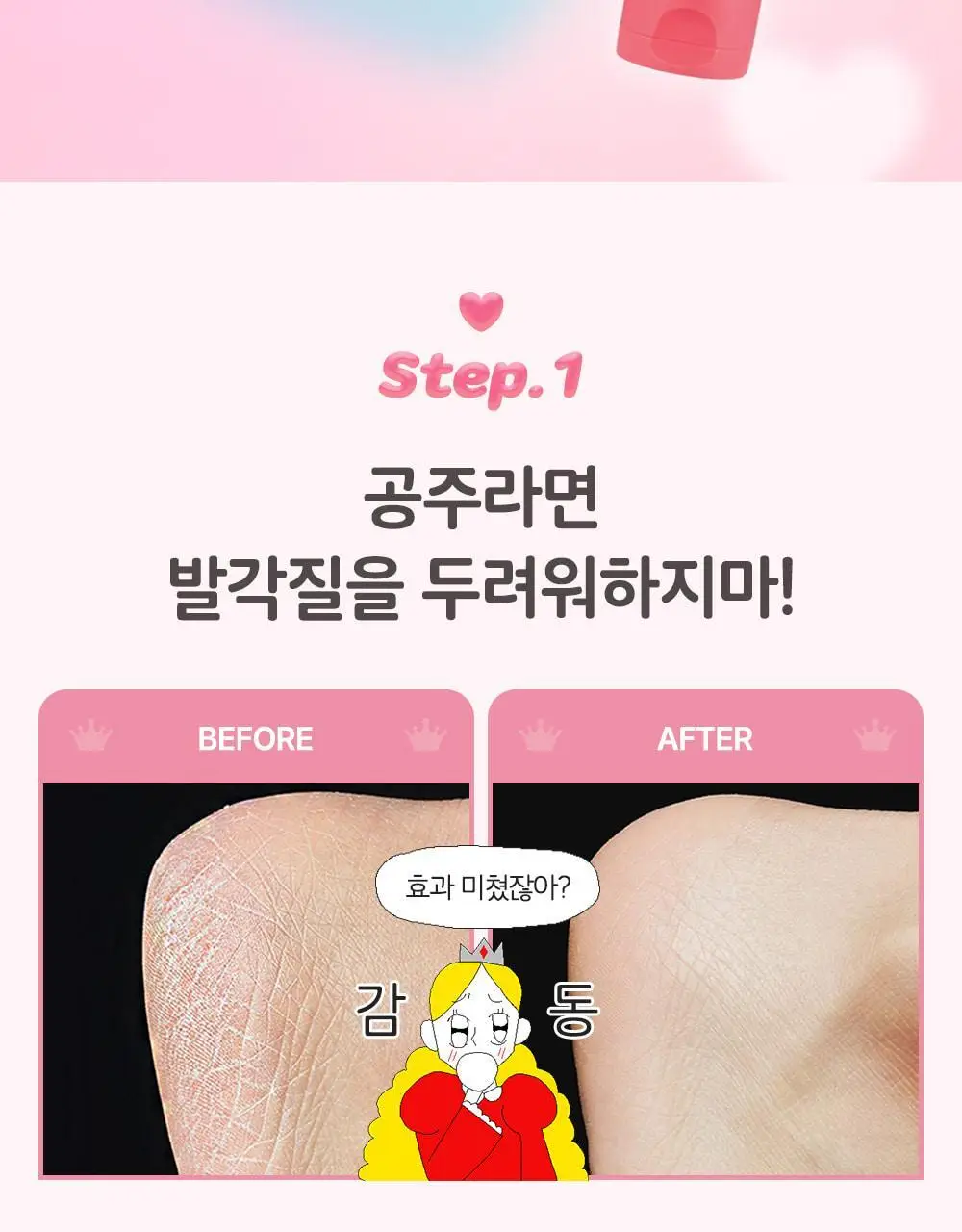 [매끈발템/올인원풋케어] 플루 퍼펙트 발 각질 케어 세트 (발각질 제거기+크림) 상세페이지 5